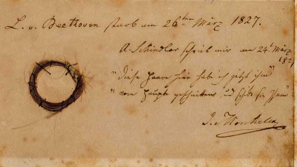 DNA from Beethoven’s hair hints at what killed the composer