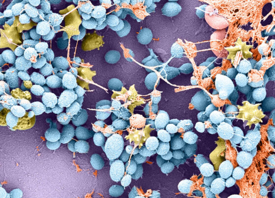 A magnified image of Candida auris, seen in blue, while nearby immune cells are seen in yellow.