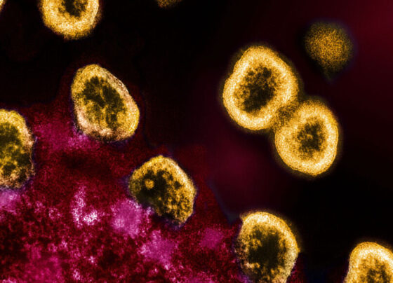 An image of HIV particles seen in yellow replicating from an infected T cell seen in pink.