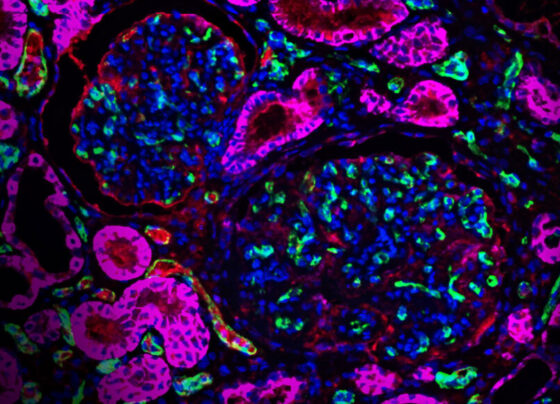 microscope image showing pig kidney tissue with human proteins in fuchsia