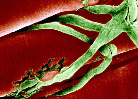 An image of green nerve cells attached to red muscle fibers.