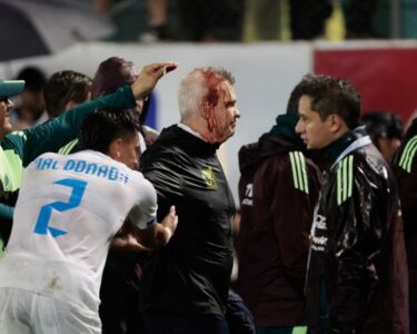 Mexico soccer manager Javier Aguirre struck by can thrown onto the pitch from stands, left with bloodied head | CNN